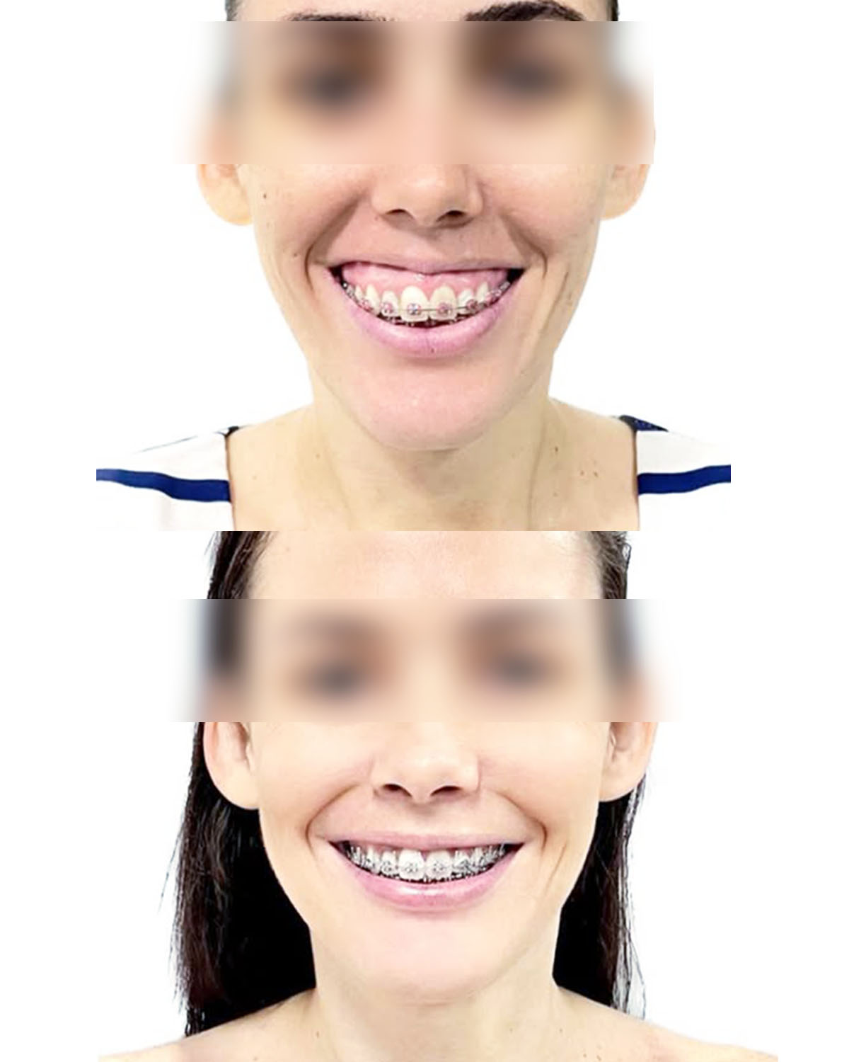 Cirurgia e Traumatologia Buco-Maxilo-Facial