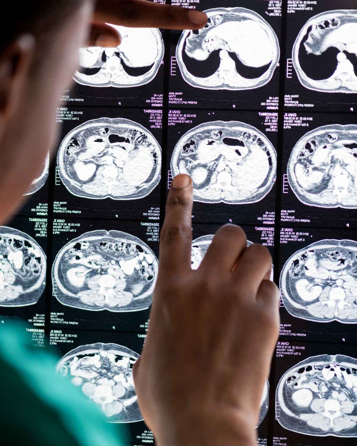 Neurologia Especialidade