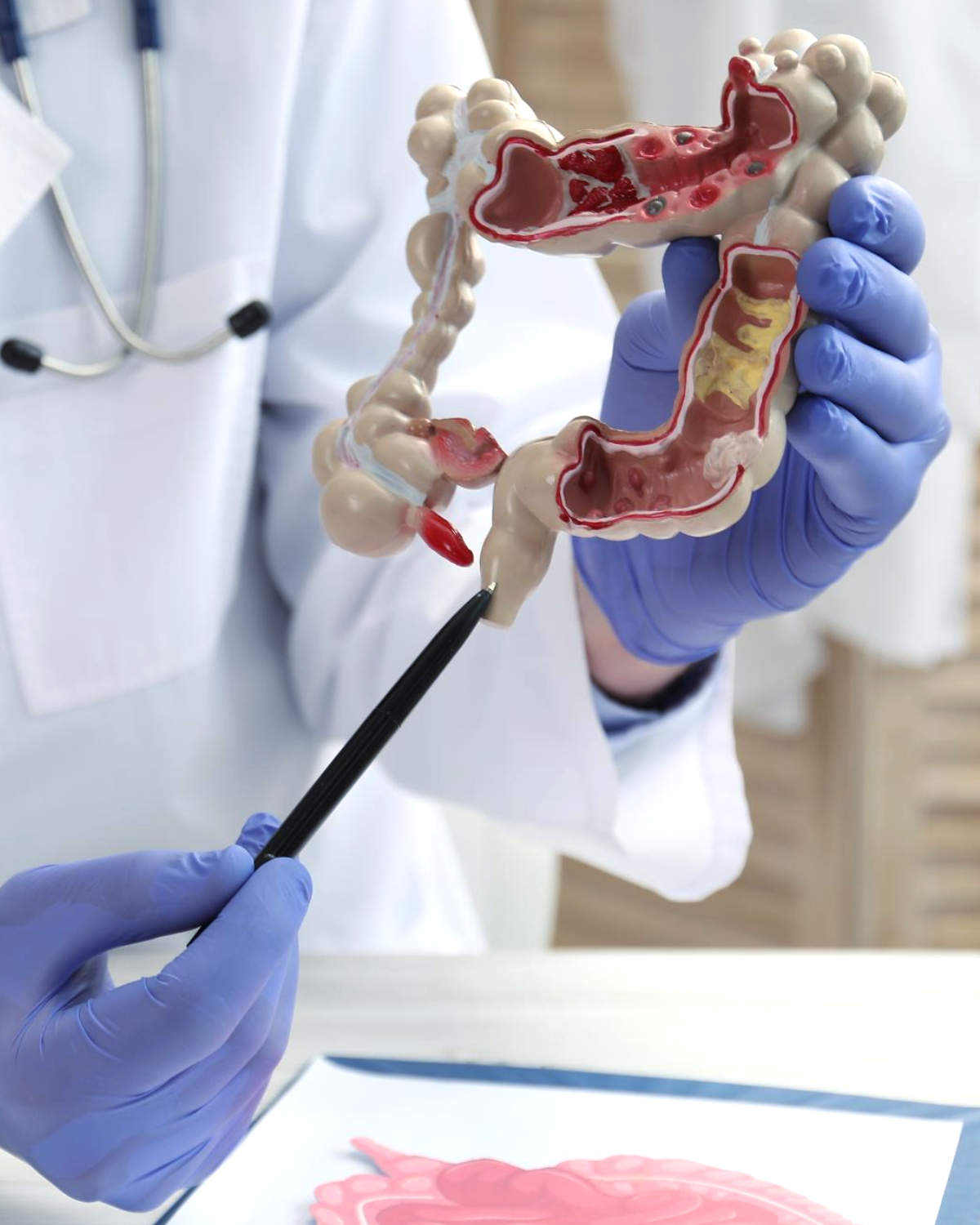 Proctologia Especialidade