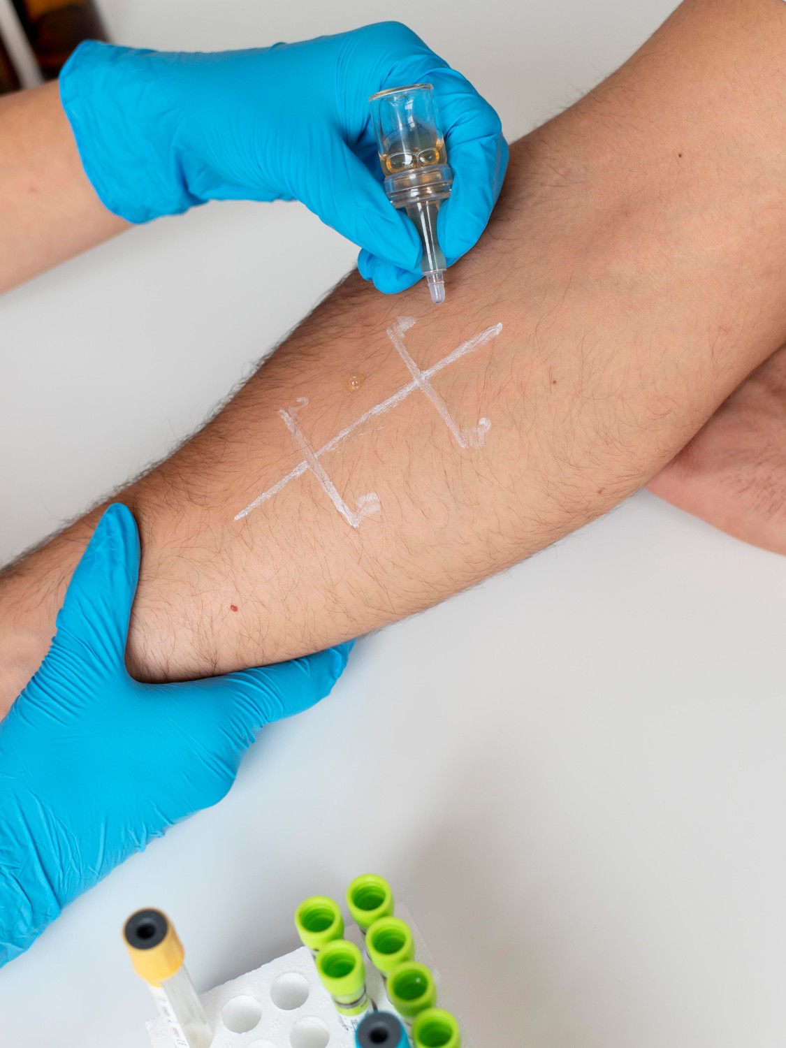 Especialidade Alergia e Imunologia (Personalizado)